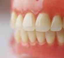 Akril zubni nadomjestak: prednosti i mane, recenzije