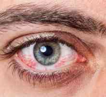 Alergija na oči: kako se postupa, učinkovite metode i preporuke