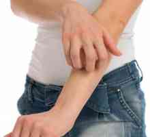 Alergija na rukama i nogama: uzroci, simptomi i mogućnosti liječenja