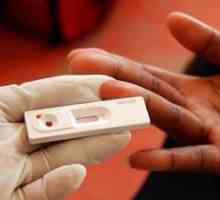 HIV test: uvjeti spremnosti, gdje i kada da se