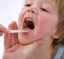 Grlobolja u djece: lijek, što su simptomi i uzroci bolesti