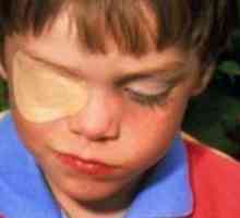 Liječenje Hardver oka u djece: opis postupka, učinkovitost i mišljenja