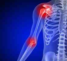 Bol u ruku na ramenu joint: uzroka, za prevenciju, liječenje. Bol u ramenu joint lijeve i desne ruke