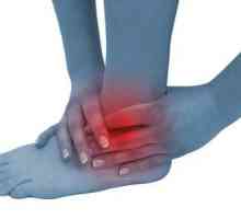 Bolesti koje utječu na gležanj zglobova: artritis