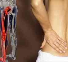Bol u leđima zrači na nozi: uzroci, liječenje