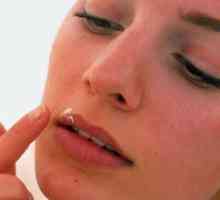 Liječiti hladno čireve na usnama?