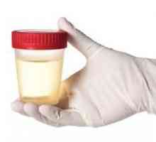 Što je analiza urina na Nechiporenko? Dekodiranje urina Nechiporenko. Kako mokriti po Nechiporenko