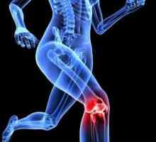 Što je deformiran osteoartritis koljena?