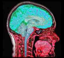 Koja je dijagnoza MR? Mogućnost MRI dijagnostike. Dijagnoza mozga MR. Recenzije MRI dijagnostiku
