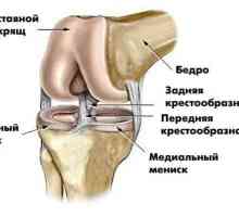 Što je MR koljena kao događaj koji će MR koljena?