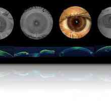 Što je optička koherentna tomografija oči?