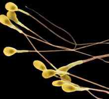 Što je sperma? Značajke muškog gameta