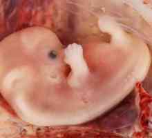 Što je izvanmaternične trudnoće i koliko opasno je to?