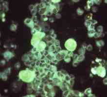Citomegalovirus: što je to i koliko je opasna ova bolest?