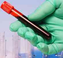 Zašto nam je potrebna test krvi u onkologiji?