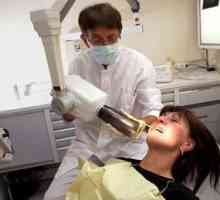 Zašto vam je potrebna rendgenska zubi