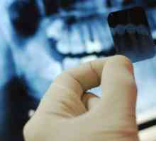 Dokumenti o porezne olakšice za liječenje zuba. Porezne olakšice implantacija zuba