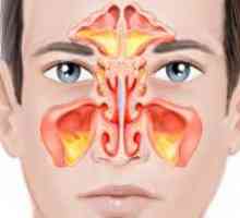 Dvostrane sinusitis: simptomi i liječenje