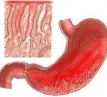 Gastritis: simptom je odjednom, i liječenje - od života
