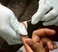 Gdje i kako se testira na HIV anonimno