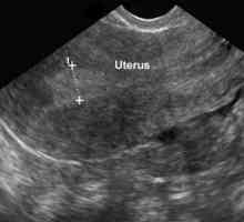 Ginekološki ultrazvuk: bilo koji dan ciklusa, gdje, dešifriranja