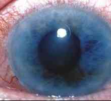 Liječenje glaukoma na prvi znak bolesti