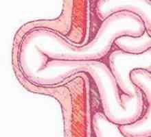 Abdominalna hernija: njihovi simptomi i liječenje