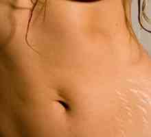Informacije za žene: kako ukloniti strije na trbuhu