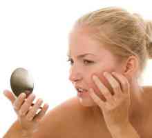 Učinkovita krema za iritaciju kože