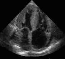 Ehokardiografija srce: značajke ovog istraživanja i indikacije za njegovu ponašanju