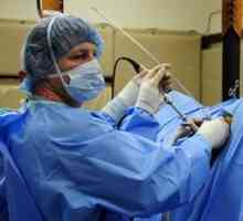 Endoskopskim operacijama: značajke, prednosti i mane