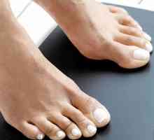 Sportaš stopala: uzroci, simptomi i liječenje