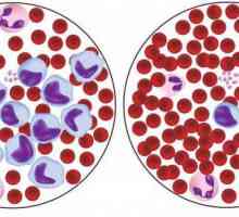 U crvenim krvnim stanicama smanjuje: mogući uzroci