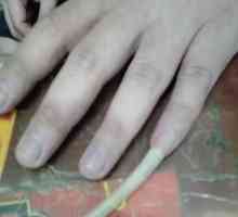 Koliko dugo i zašto ljudi rastu svoje nokte na malom prstu