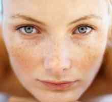 Kako da biste dobili osloboditi od freckles na lice kod kuće?