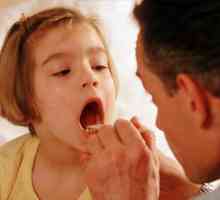 Kako liječiti angina u djece
