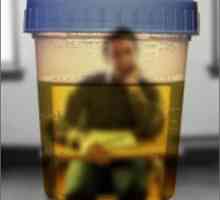 Kako proći ispravno test urina?