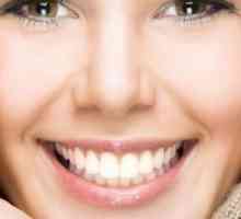 Kako izravnati zube bez aparatića? Capa zub