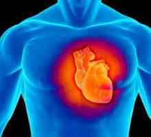 Kardiomiopatija - to ... dishormonal i dismetabolični kardiomiopatija