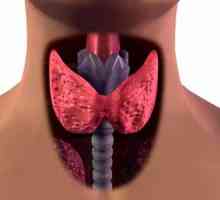 Kliničke manifestacije i liječenje autoimuni tiroiditis