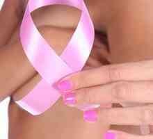 Kada mamografije i kako se pripremiti za to?