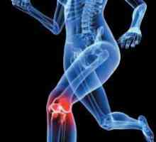 Zglob koljena. Ligamenta ruptura: opseg štete i tretmani