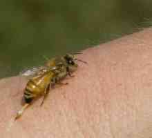 Savjetovanje sa stručnjakom: Što učiniti ako ugrizla pčela