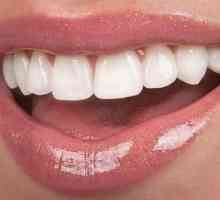 Plastični krune na prednjim zubima: indikacije, recenzije, fotografije