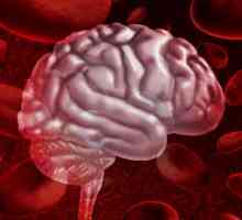 Krvarenje u mozgu: simptomi, liječenje, posljedice i prognoze