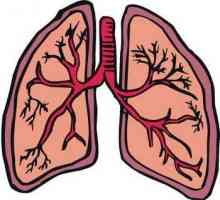 Liječenje bronhitisa i njezinih simptoma