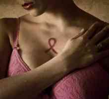 Liječenje raka dojke u Izraelu, glavne značajke