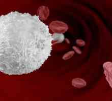 Bijele krvne stanice: normalne žene. Norma leukociti u trudnica