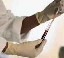 Bijele krvne stanice su povećani u krvi djeteta: Uzrokuje