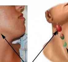 Limfni čvor u liječenju vratu i uzrocima
